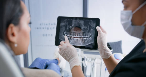 Licensed Wisdom Tooth Removal service in Virginia, VA - Smile Center Dentistry
